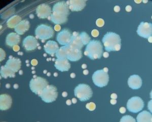 Bacteria on Agar Plate